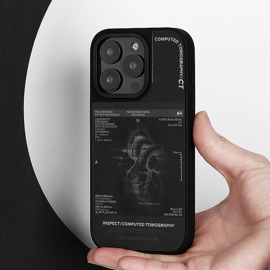 X-Ray Film - Heart
