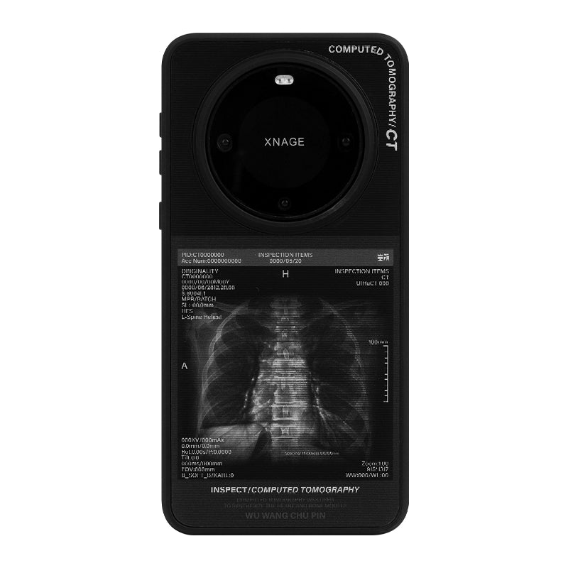 X-ray Lungs
