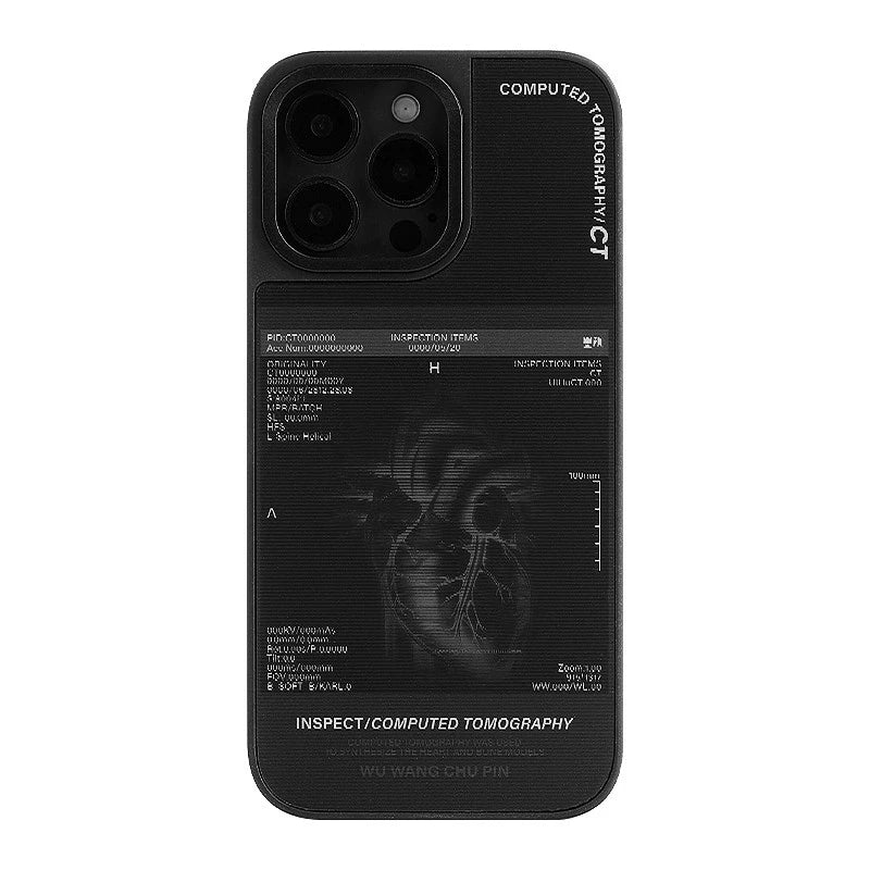 X-Ray Film