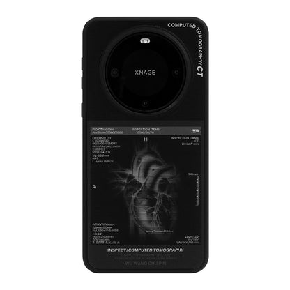 X-ray Film Heart