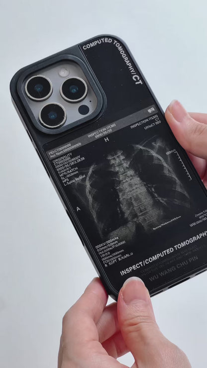 X-Ray Film - Chest