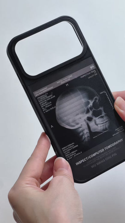 X-ray Film - Skull